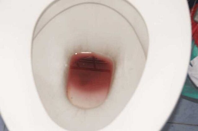 اكتشاف على الرجال عندما يكونون متحمسين